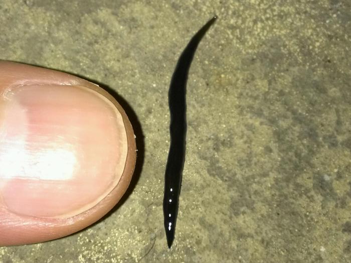 Balita Sukabumi Meninggal, 1 Kg Cacing Ditemukan Sebelum Tutup Usia